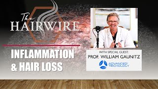 Inflammation \u0026 Hair Loss Interview with Trichology Expert William Gaunitz