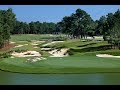 Pinehurst No.4: The Vistas