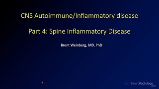 Imaging CNS autoimmune and inflammatory disease - 4 - Spine inflammatory disease