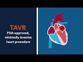 Transcatheter Aortic Valve Replacement (TAVR): What it is, how it works, and what to expect after