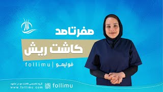 کاشت ریش چگونه انجام می شود؟ هر آنچه که باید در مورد کاشت ریش و سبیل بداند