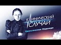 Клинический случай Надежды Крупской. У врачей того времени просто не было шансов