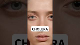 What is Cholera #cholera #vibriocholera #infection