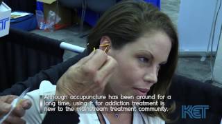 Using Acupuncture for Opioid Withdrawal and Detox | Inside Opioid Addiction | KET