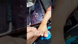 ആദി പശ test ചെയ്തത | glue remove in skin |#shorts #short