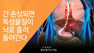 간 손상되면 독성물질이 뇌로 흘러 들어간다 - (2010.5.13_332회 방송)_치명적인 바이러스, A형간염의 경고