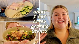 what i eat in a day | 2 months after gastric bypass