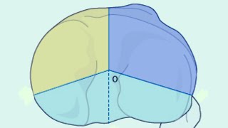Tibial plateau fractures - Current Concepts