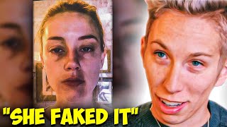 "She Faked It" Amber's Best Friend Reveals Her Bruises Were Fake