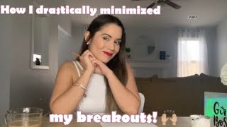 How I Minimized My Acne Breakouts | Acne Diet