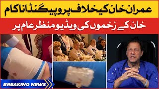 Imran Khan Injuries and Wounds Video | PMLN Propaganda Exposed | Breaking News