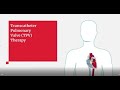 Edwards SAPIEN 3 Transcatheter Pulmonary Valve Replacement Procedure Animation