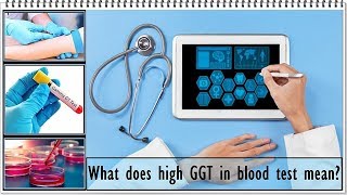 GGT Blood Test - Meaning,  Normal Range, High (Causes)