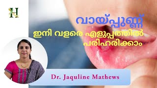 Mouth ulcer | വായ്പ്പുണ്ണ് ഇനി എളുപ്പത്തിൽ പരിഹരിക്കാം..| Dr Jaquline