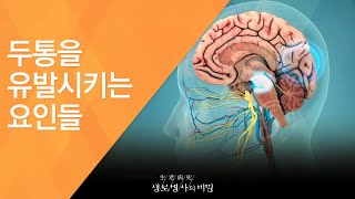 두통을 유발시키는 요인들 - (2017.2.22_611회 방송)_편두통, 참지 말고 치료하라