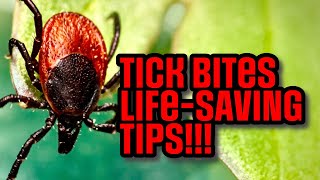 STOP Tick Bites from Becoming Lyme Disease! MUST KNOW Bug Bite FACTS