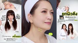 Ultherapy |ยกจริง! เก็บจริง! จนคุณฮันนี่ ภัสสร ยังต้องอึ้ง! | ผิวยกกระชับ