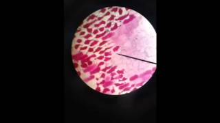 Plasmolysis Lab