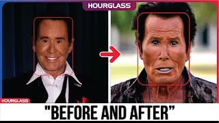 SHOCKING Male Plastic Surgery Transformations! | You’d Never Recognize Today