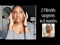 My Fibroid Story + Advice Before Getting Surgery