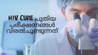 എച്ച്ഐവി വിജയം എന്ന് സാധ്യമാകും ? പരീക്ഷണഘട്ടത്തിൽ എലികളിൽ ഫലപ്രദം..!