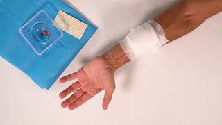 ActiGraft Forearm Application