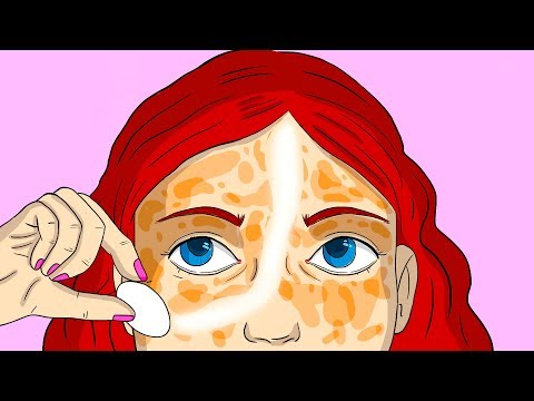 How can we keep our skin Colour fair?