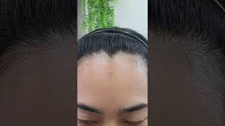 #สักไรผมแฮร์สโตรค #HairLineStroke #สักไรผมปรับกรอบหน้า #สักแก้ผมบาง #สักปิดหัวล้านหน้าผากกว้าง