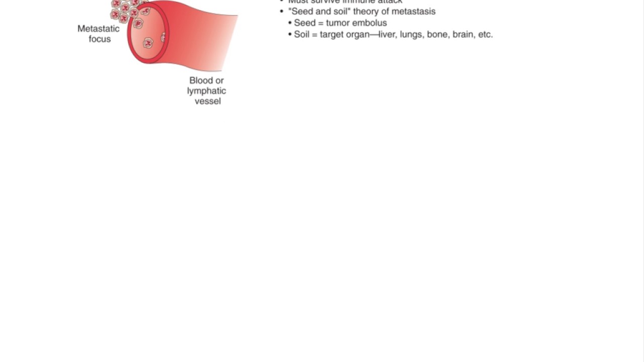 Pathology Neoplasia Part 1 Youtube