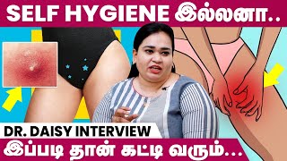 Junk Food சாப்பிட்டா அந்தரங்க பகுதியில் கட்டியா Pimple வரும் | Full Pimple History | Doctor Daisy