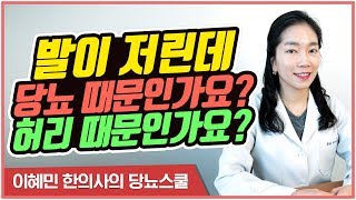 발저림 증상, 당뇨 때문일까? 허리 때문일까? | 당뇨문의 1644-5178