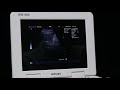 DW-580 ultrasound machine operation part 4