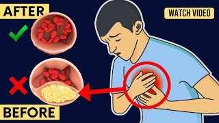Just 3 Ways to Control High Blood Pressure and Clogged Arteries Naturally