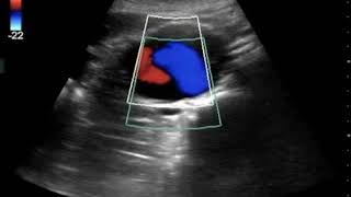 #POCUS Case of the Month: November 2018