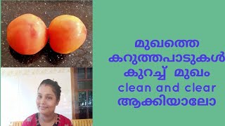 മുഖത്തെ കറുത്തപാടുകളും കരുവാളിപ്പും മാറ്റി മുഖം clear ആക്കിയാലോ