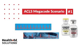 ACLS Megacode Scenario 1: Supraventricular Tachycardia (SVT)