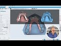 Maestro 3D | Dental Studio | User Video Tutorials | Unilabor | How many aligners?