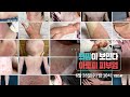 희망이 보인다 아토피피부염  [6월28일 방송 예고]