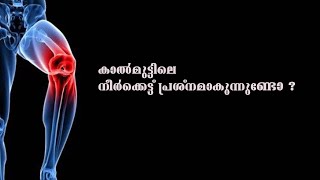 കാൽമുട്ടിൽ ഉണ്ടാകുന്ന നീർക്കെട്ട് അറിയേണ്ട കാര്യങ്ങൾ എന്തെല്ലാം ?