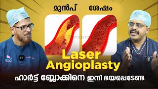 ബ്ലോക്കിനെ ഇനി ഭയപ്പെടേണ്ട Laser Angioplasty ഹൃദയം കൂടുതൽ സുരക്ഷിതമാകുന്നു | Heart Block Treatment