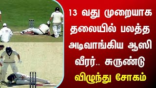 13 வது முறையாக தலையில் பலத்த அடிவாங்கிய ஆஸி வீரர்..சோகம் ind vs eng test live cricket