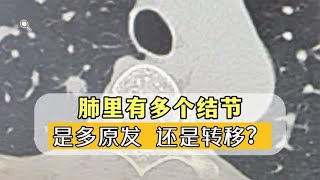 肺里不止一个结节！会不会是转移？医生教您判断