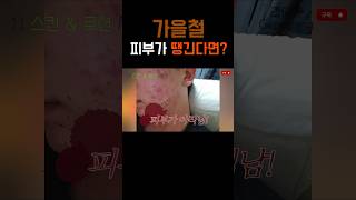 가을에 피부가 너무 건조하다면? #쇼츠