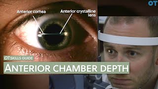 OT skills guide: Anterior chamber depth