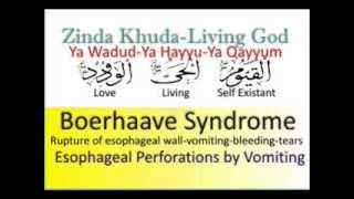 Boerhaave Syndrome