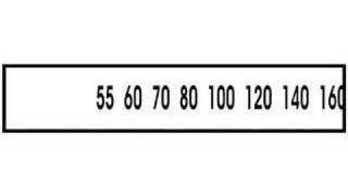 Alignment Procedure 2 Aligning Radio