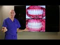 25 amazing dental implant bridge cases part 1