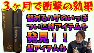 ハゲからフサフサへの道のり、11000円買う時は高いって思ったけど今は安く感じるよ！！