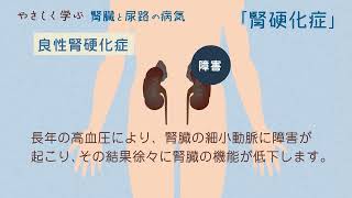 やさしく学ぶ 腎硬化症