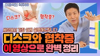 ‘협착증’이 무슨 병인지 잘 모르시겠다면? 세상에서 가장 쉽게 설명해 드립니다! 이경석의 척추88 #54